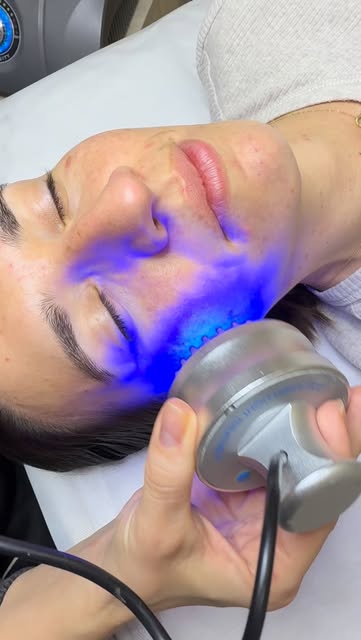 Tratamiento facial de estética avanzada en Insomnia